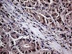 HABP2 Antibody in Immunohistochemistry (Paraffin) (IHC (P))