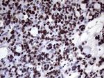 XRN2 Antibody in Immunohistochemistry (Paraffin) (IHC (P))