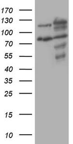 XRN2 Antibody in Western Blot (WB)