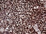 ZRANB2 Antibody in Immunohistochemistry (Paraffin) (IHC (P))