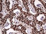 ZRANB2 Antibody in Immunohistochemistry (Paraffin) (IHC (P))