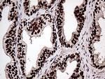 ZRANB2 Antibody in Immunohistochemistry (Paraffin) (IHC (P))