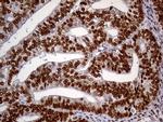 MEIS1 Antibody in Immunohistochemistry (Paraffin) (IHC (P))