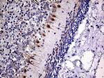 SLC22A17 Antibody in Immunohistochemistry (Paraffin) (IHC (P))