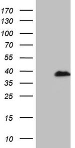 RPAIN Antibody in Western Blot (WB)