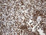 hnRNP H1 Antibody in Immunohistochemistry (Paraffin) (IHC (P))