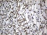 hnRNP H1 Antibody in Immunohistochemistry (Paraffin) (IHC (P))