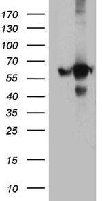GDI1 Antibody in Western Blot (WB)