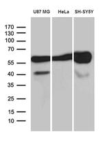 GDI1 Antibody in Western Blot (WB)