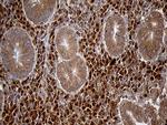 CHIA Antibody in Immunohistochemistry (Paraffin) (IHC (P))