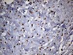 PYGM Antibody in Immunohistochemistry (Paraffin) (IHC (P))