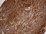 PYGM Antibody in Immunohistochemistry (Paraffin) (IHC (P))