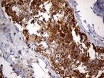 PYGM Antibody in Immunohistochemistry (Paraffin) (IHC (P))