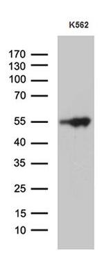 VRK2 Antibody in Western Blot (WB)