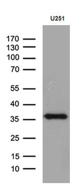 DTWD1 Antibody in Western Blot (WB)