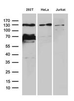 ZNF655 Antibody in Western Blot (WB)