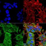 AMIGO1 Antibody in Immunocytochemistry (ICC/IF)