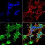 Stargazin Antibody in Immunocytochemistry (ICC/IF)