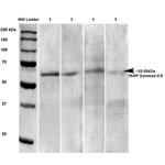 Stargazin Antibody in Western Blot (WB)