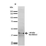 SCN2B Antibody in Western Blot (WB)