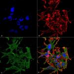 GABBR1 Antibody in Immunocytochemistry (ICC/IF)