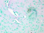 CaV1.2 Antibody in Immunohistochemistry (Paraffin) (IHC (P))