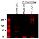 CaV1.2 Antibody in Immunoprecipitation (IP)