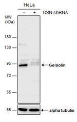 Gelsolin Antibody