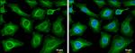 PLS3 Antibody in Immunocytochemistry (ICC/IF)