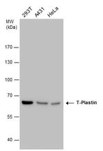 PLS3 Antibody in Western Blot (WB)