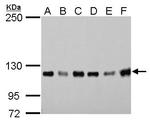 GEF-H1 Antibody in Western Blot (WB)