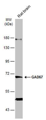 GAD67 Antibody in Western Blot (WB)