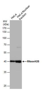 RNaseH2B Antibody in Western Blot (WB)