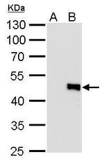 IL-28B Antibody in Western Blot (WB)