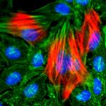 Calponin 1 Antibody in Immunocytochemistry (ICC/IF)