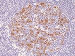 Cyclin B1 Antibody in Immunohistochemistry (Paraffin) (IHC (P))