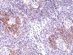 CD49d (Integrin alpha 4) Antibody in Immunohistochemistry (Paraffin) (IHC (P))