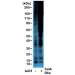 Phosphothreonine Antibody in Western Blot (WB)