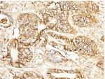 CD147 Antibody in Immunohistochemistry (Paraffin) (IHC (P))