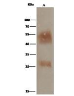 CD147 Antibody in Immunoprecipitation (IP)