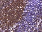 CD19 Antibody in Immunohistochemistry (Paraffin) (IHC (P))