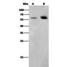 CD4 Antibody in Western Blot (WB)