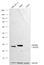 15-PGDH Antibody in Western Blot (WB)