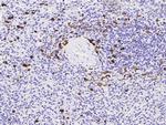 MZB1 Antibody in Immunohistochemistry (Paraffin) (IHC (P))