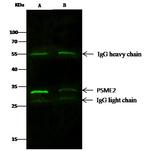 PSME2 Antibody in Immunoprecipitation (IP)