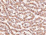 Heparin Cofactor II Antibody in Immunohistochemistry (Paraffin) (IHC (P))