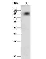 Prothrombin Antibody in Western Blot (WB)