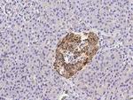 CX3CL1 Antibody in Immunohistochemistry (Paraffin) (IHC (P))