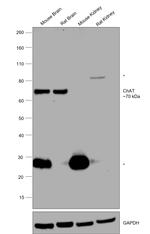 ChAT Antibody in Western Blot (WB)