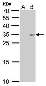 COL11A2 Antibody in Western Blot (WB)